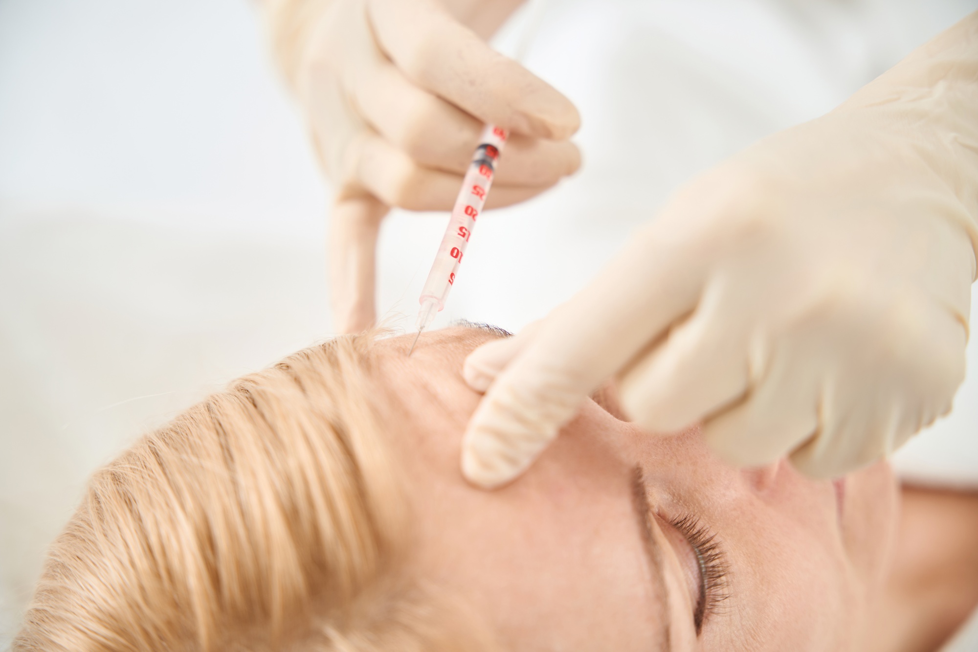 Botox and Its Role in Enhancing Neuroplasticity: A New Perspective in Therapeutic Applications